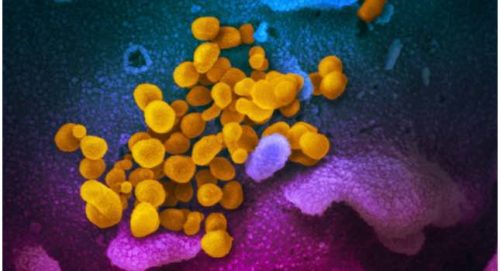 该扫描电子显微镜图像显示SARS-COV-2（黄色） - 已知为2019-NCOV，该病毒导致从患者的Covid-19分离，从实验室培养的细胞表面（蓝色/粉红色）出现。礼貌：Massachusetts技术研究所（麻省理工学院）